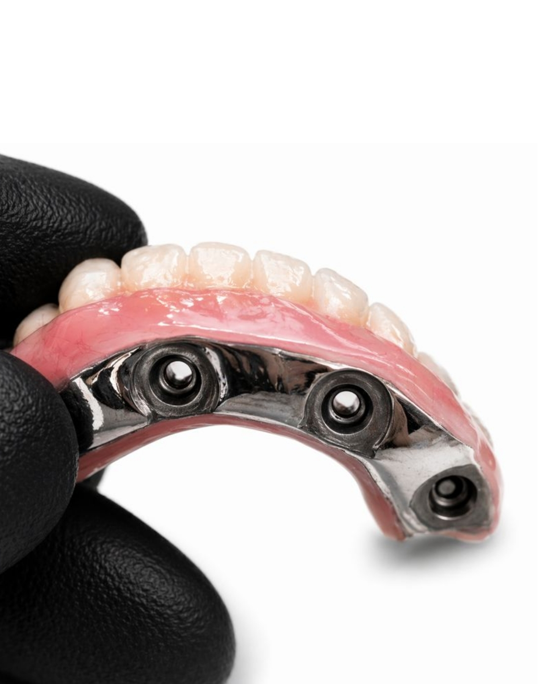 Advanced Implant  -  product
